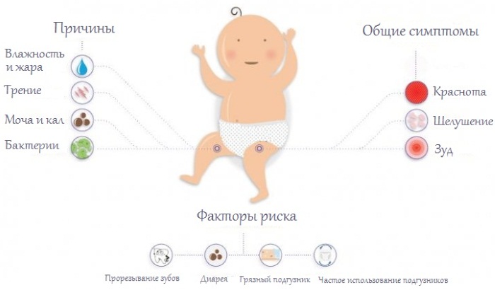 Опрелости у новорожденных. Чем лечить: медицинские и народные средства. Как выглядят на попе, шее, под мышками, между ног