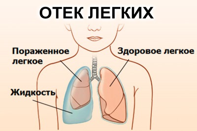 Бускопан свечи. Инструкция по применению перед родами, при беременности, для детей. Аналоги, отзывы