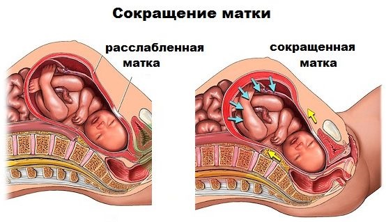 Но-Шпа во время беременности. Как принимать в 1, 2, 3 триместре, при боли в животе