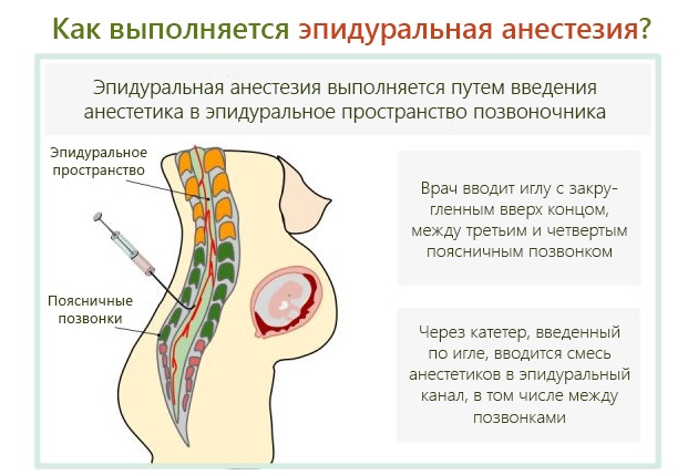 Но-Шпа во время беременности. Как принимать в 1, 2, 3 триместре, при боли в животе