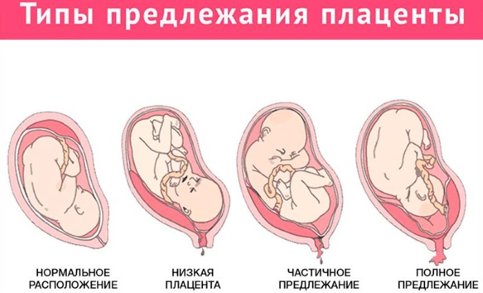 Плацента и послед фото