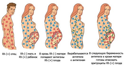 Как выглядит грудь на ранних сроках фото