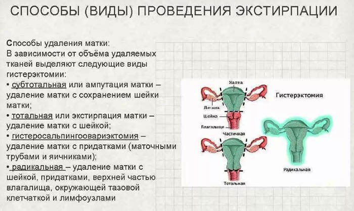 Матка с придатками фото